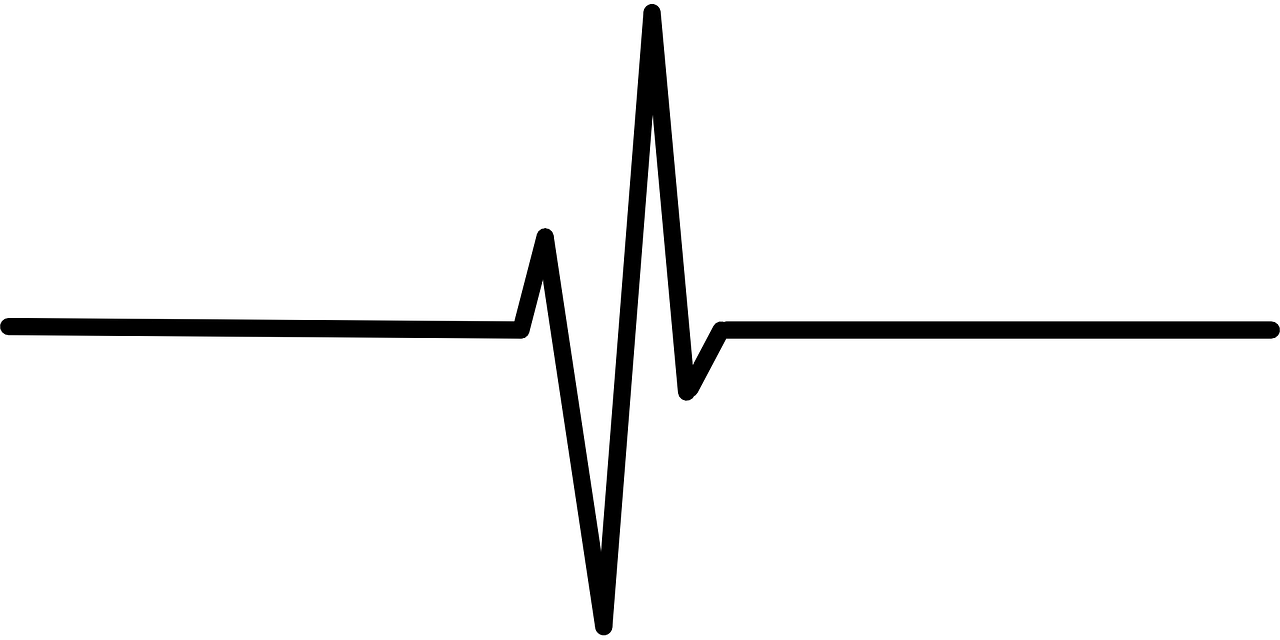 heartbeat, ekg, ecg-304130.jpg